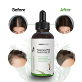 Rosemary Mint- Scalp & Hair Oil