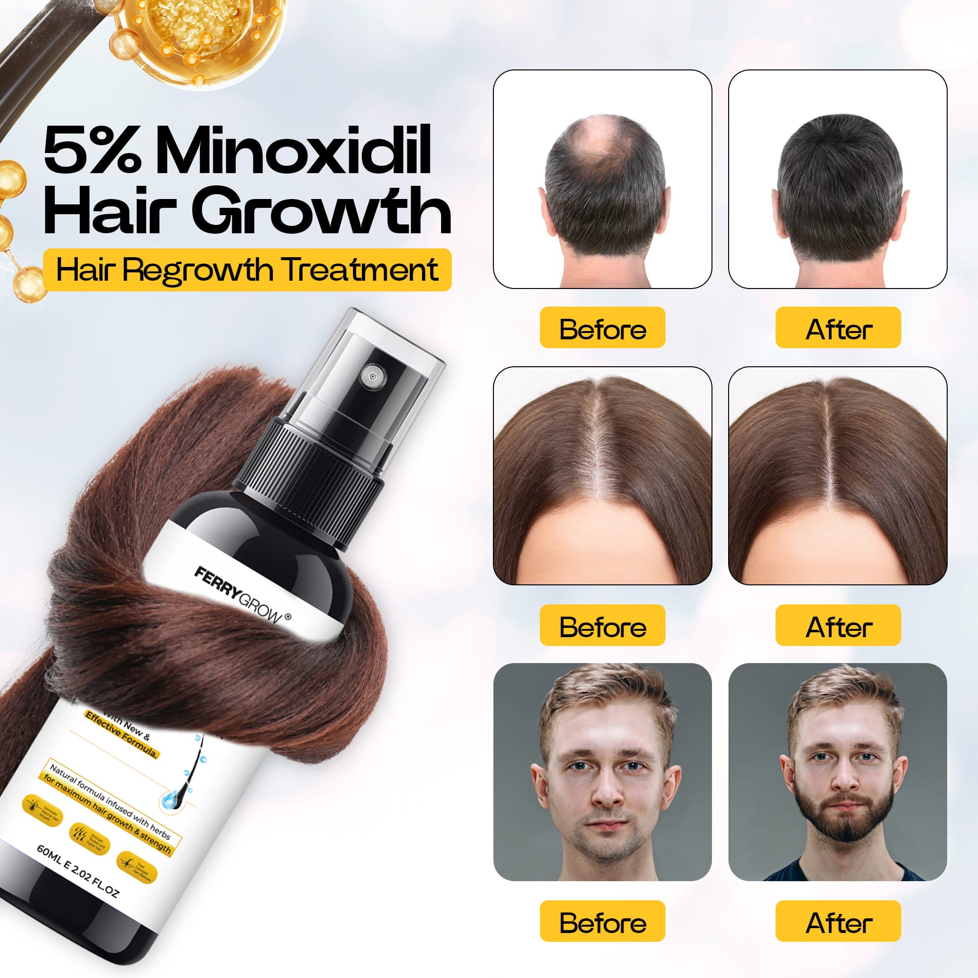 FERRYGROW Hair Growth Serum