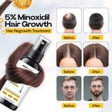 FERRYGROW Hair Growth Serum