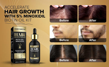 FERRYGROW Hair Growth Serum